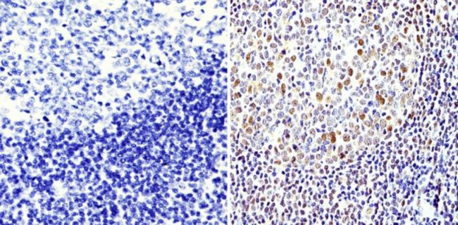 APE1 Antibody in Immunohistochemistry (Paraffin) (IHC (P))