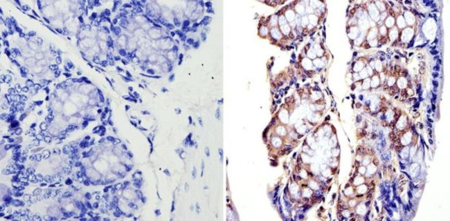 APE1 Antibody in Immunohistochemistry (Paraffin) (IHC (P))