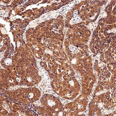 CIP2A Antibody in Immunohistochemistry (Paraffin) (IHC (P))