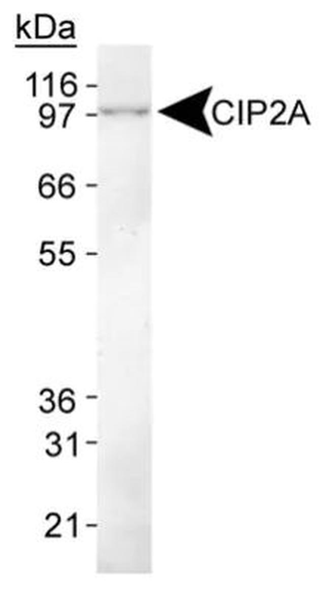 CIP2A Antibody in Western Blot (WB)