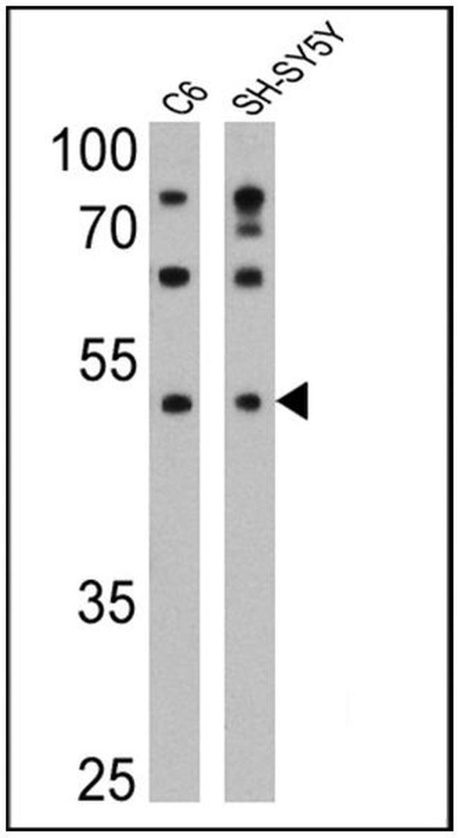 DRD5 Antibody in Western Blot (WB)