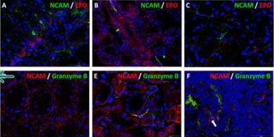 CD56 Antibody in Immunocytochemistry (ICC/IF)