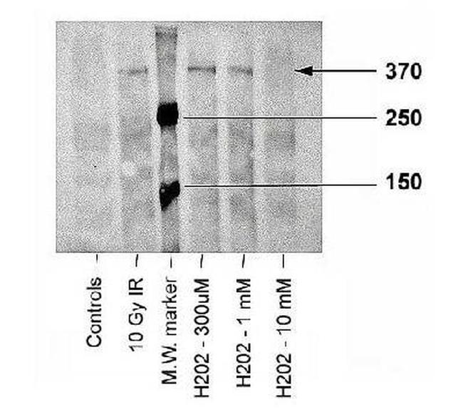 Phospho-ATM (Ser1981) Antibody in Western Blot (WB)