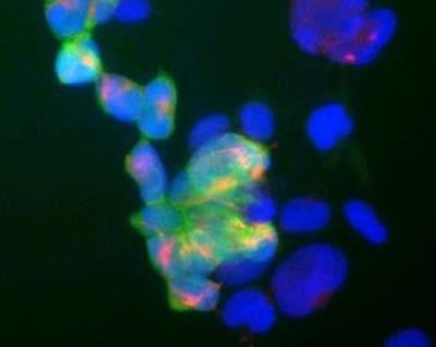 PGP9.5 Antibody in Immunocytochemistry (ICC/IF)