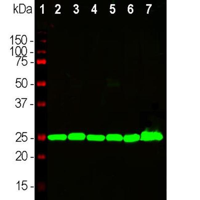 PGP9.5 Antibody in Western Blot (WB)