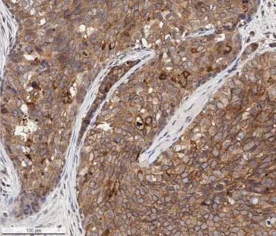 EpCAM Antibody in Immunohistochemistry (Paraffin) (IHC (P))