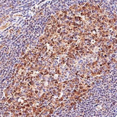 LMO2 Antibody in Immunohistochemistry (Paraffin) (IHC (P))