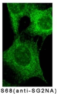 STRN3 Antibody in Immunocytochemistry (ICC/IF)