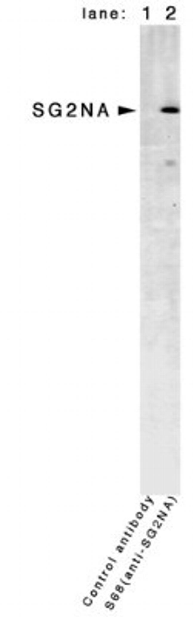 STRN3 Antibody in Western Blot (WB)