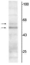 THRA Antibody in Western Blot (WB)