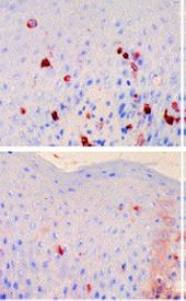 FceR1 alpha Antibody in Immunohistochemistry (Frozen) (IHC (F))