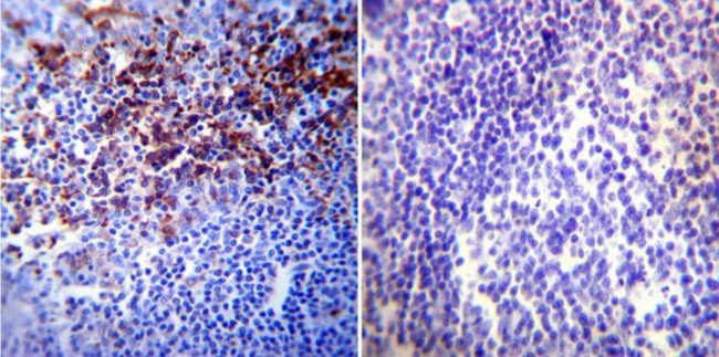 HIF1A Antibody in Immunohistochemistry (Paraffin) (IHC (P))