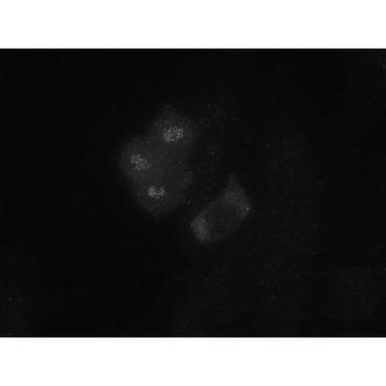 Bub1 Antibody in Immunocytochemistry (ICC/IF)