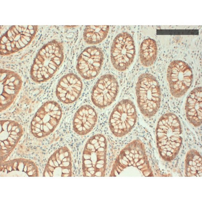 Cytokeratin Pan Type I Antibody in Immunohistochemistry (Paraffin) (IHC (P))