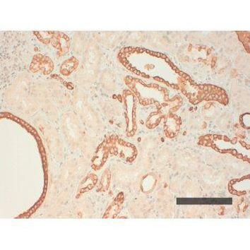 Cytokeratin Pan Type I Antibody in Immunohistochemistry (Paraffin) (IHC (P))