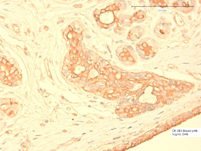 Cytokeratin Pan Type II Antibody in Immunohistochemistry (Paraffin) (IHC (P))