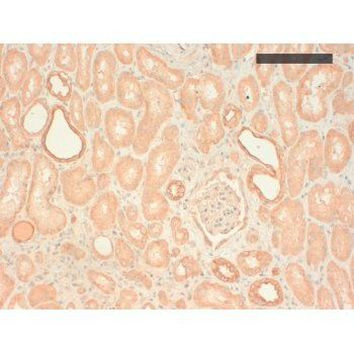 Cytokeratin Pan Type II Antibody in Immunohistochemistry (Paraffin) (IHC (P))