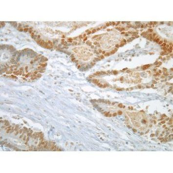 MAD2 Antibody in Immunohistochemistry (Paraffin) (IHC (P))