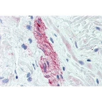 Nestin Antibody in Immunohistochemistry (Paraffin) (IHC (P))