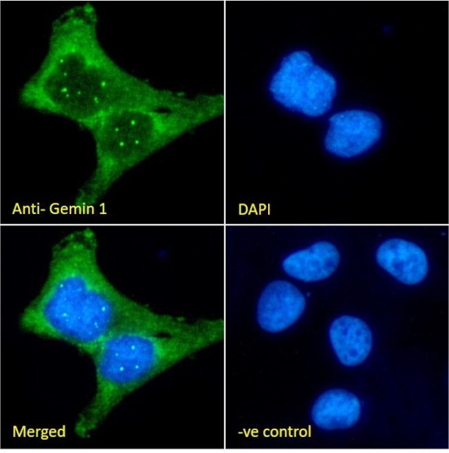 SMN1/SMN2 Antibody in Immunocytochemistry (ICC/IF)