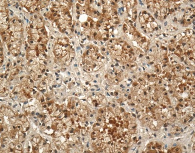 Prolactin Receptor Antibody in Immunohistochemistry (IHC)