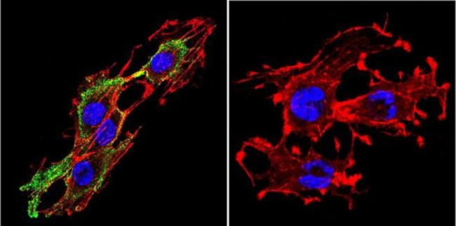 Prolactin Receptor Antibody in Immunocytochemistry (ICC/IF)