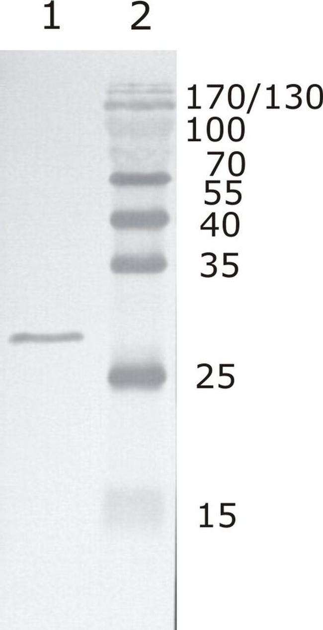 HIV1 Rev Group M Antibody in Western Blot (WB)