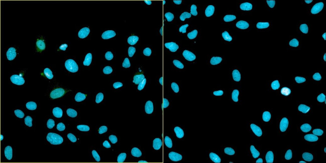 Bovine Papilloma Virus Type 1 E2 Antibody in Immunocytochemistry (ICC/IF)