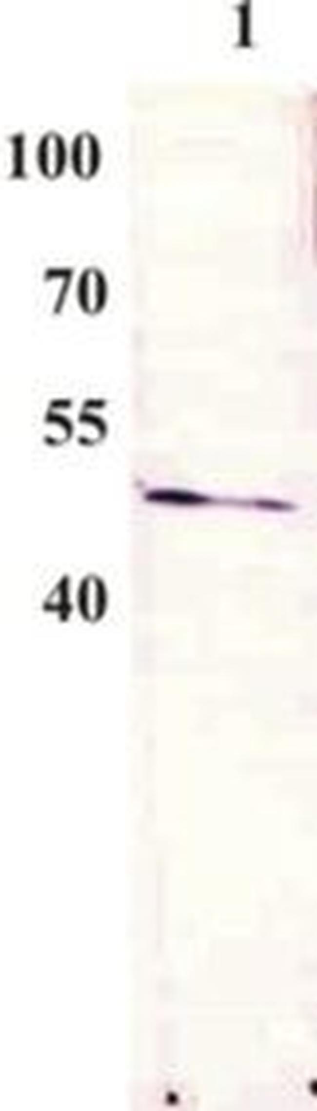 Bovine Papilloma Virus Type 1 E2 Antibody in Western Blot (WB)