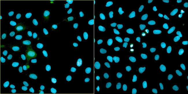 Bovine Papilloma Virus Type 1 E2 Antibody in Immunocytochemistry (ICC/IF)