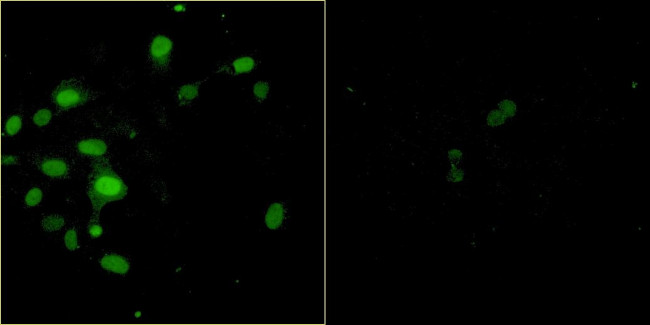 Bovine Papilloma Virus Type 1 E2 Antibody in Immunocytochemistry (ICC/IF)