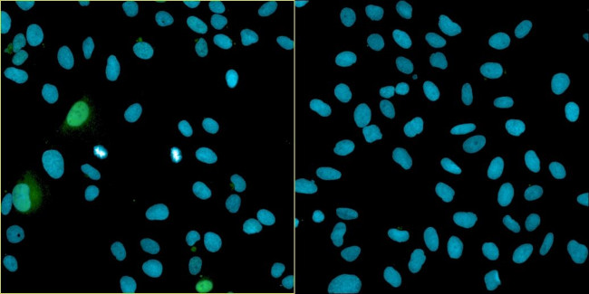 Bovine Papilloma Virus Type 1 E2 Antibody in Immunocytochemistry (ICC/IF)