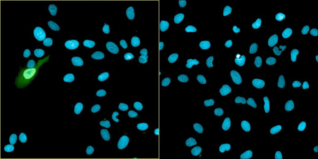 Bovine Papilloma Virus Type 1 E2 Antibody in Immunocytochemistry (ICC/IF)