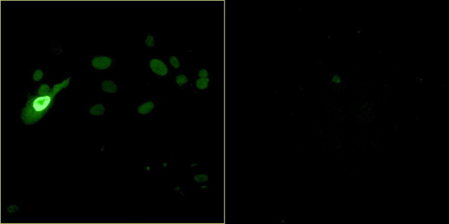 Bovine Papilloma Virus Type 1 E2 Antibody in Immunocytochemistry (ICC/IF)