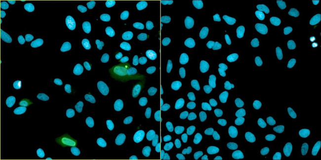 Bovine Papilloma Virus Type 1 E2 Antibody in Immunocytochemistry (ICC/IF)