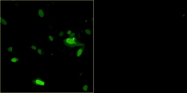 Bovine Papilloma Virus Type 1 E2 Antibody in Immunocytochemistry (ICC/IF)