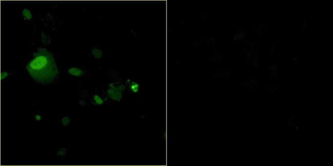 Bovine Papilloma Virus Type 1 E2 Antibody in Immunocytochemistry (ICC/IF)