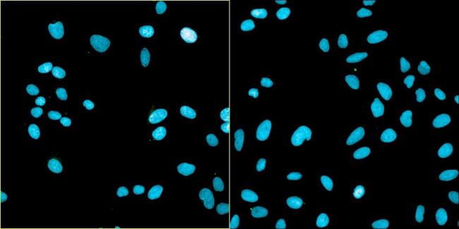 Bovine Papilloma Virus Type 1 E2 Antibody in Immunocytochemistry (ICC/IF)