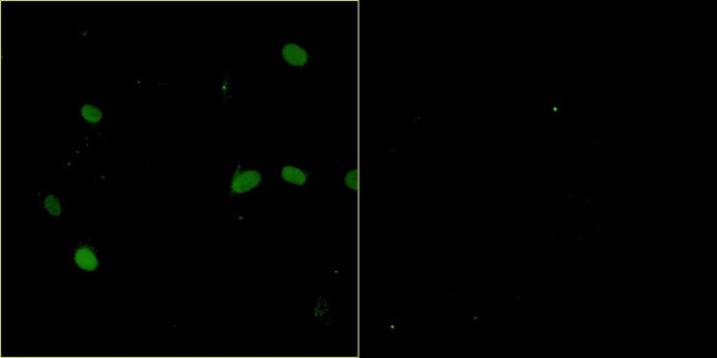 Bovine Papilloma Virus Type 1 E2 Antibody in Immunocytochemistry (ICC/IF)