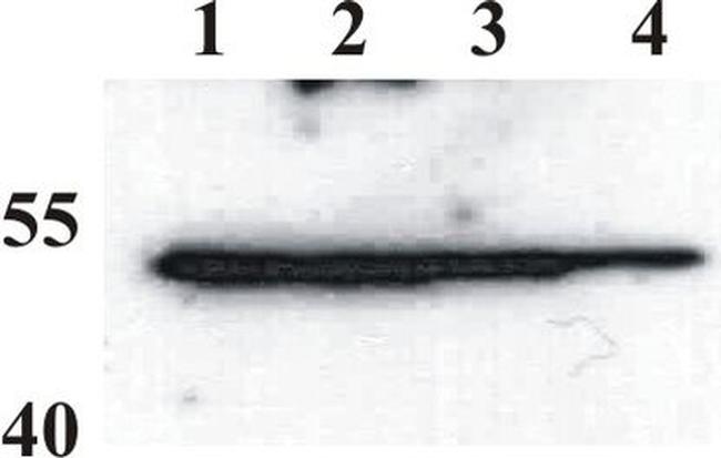 Bovine Papilloma Virus Type 1 E2 Antibody in Western Blot (WB)