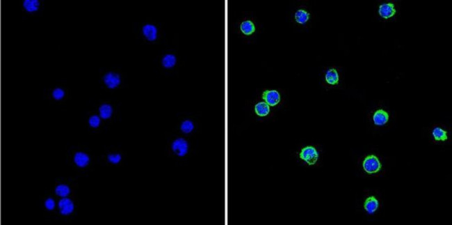 GRK1 Antibody in Immunocytochemistry (ICC/IF)