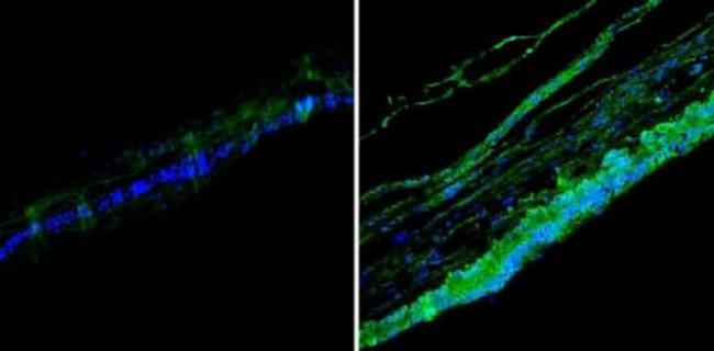 Rhodopsin Antibody in Immunohistochemistry (Paraffin) (IHC (P))