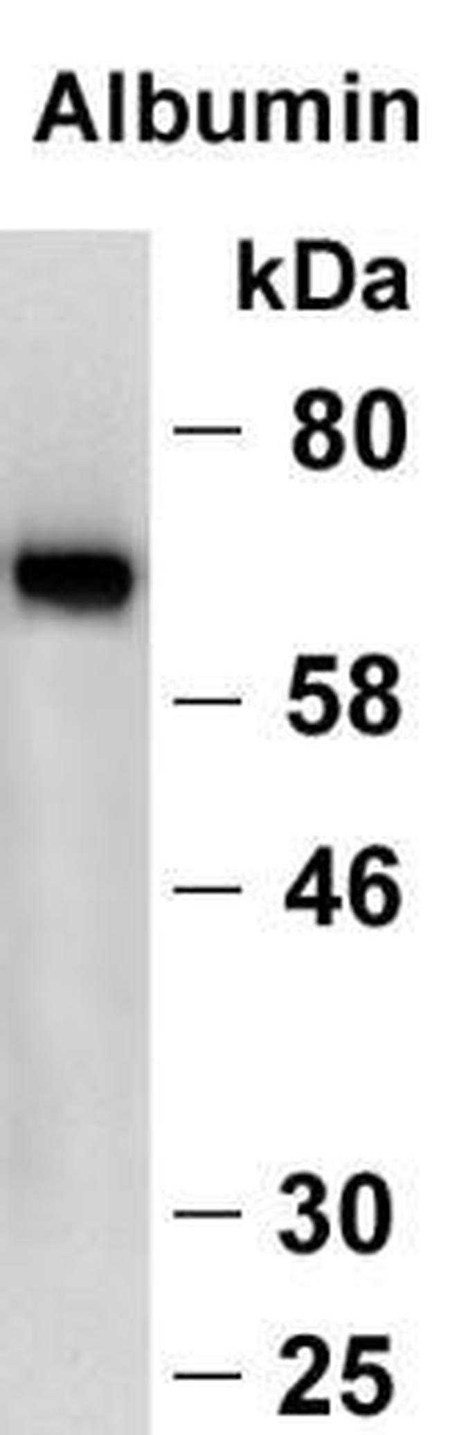 Human Serum Albumin Antibody in Western Blot (WB)