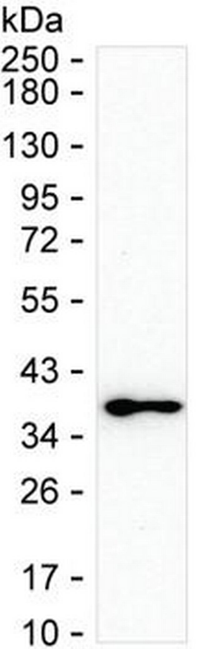 MAPRE3 Antibody in Western Blot (WB)