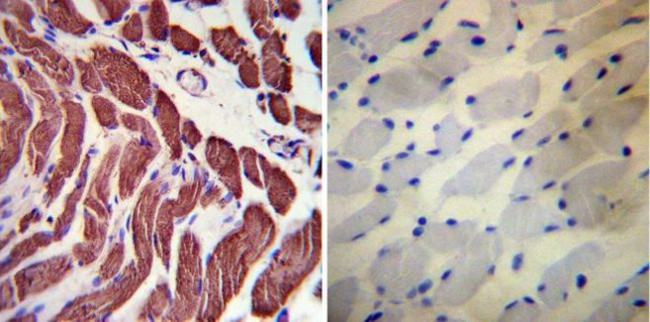 Actin Antibody in Immunohistochemistry (Paraffin) (IHC (P))