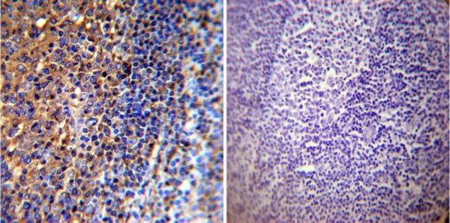 Actin Antibody in Immunohistochemistry (Paraffin) (IHC (P))