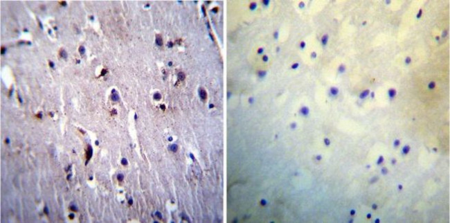 Presenilin 1 Antibody in Immunohistochemistry (Paraffin) (IHC (P))