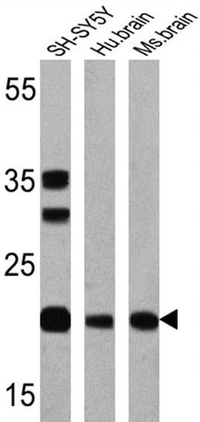 Presenilin 1 Antibody in Western Blot (WB)