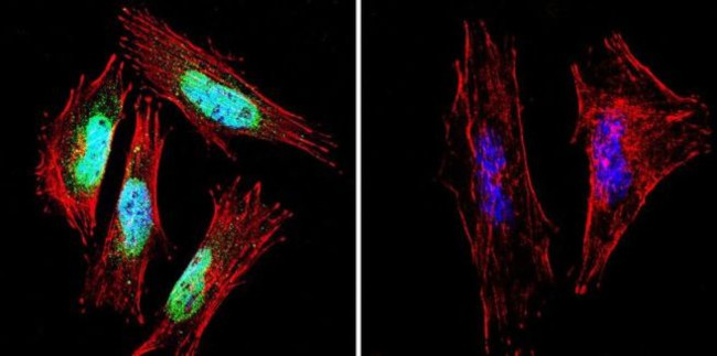 Presenilin 1 Antibody in Immunocytochemistry (ICC/IF)