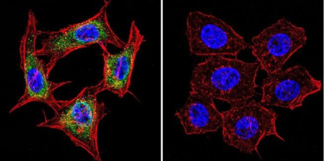 Presenilin 1 Antibody in Immunocytochemistry (ICC/IF)